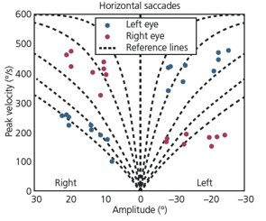 Horizontal saccadic peak velocities